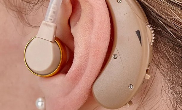Digital Hearing Aid